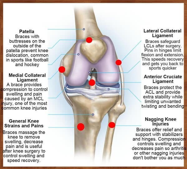 5 Common Types of Knee Braces and How to Pick the Right One for You, The  Hospital of Central Connecticut