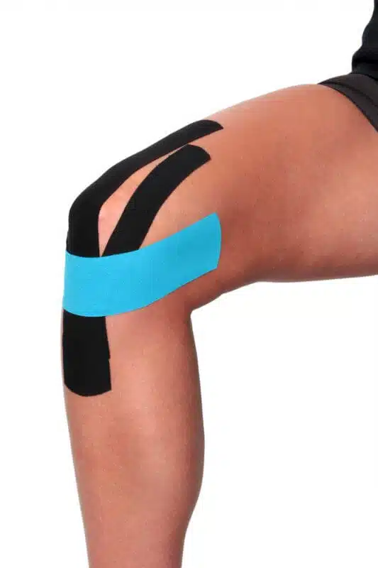 How to Correct Patellar Tracking Problem With Kinesiotape - 8 of