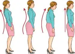 Poor Posture - Its Health Effects & How To Correct It · Dunbar Medical