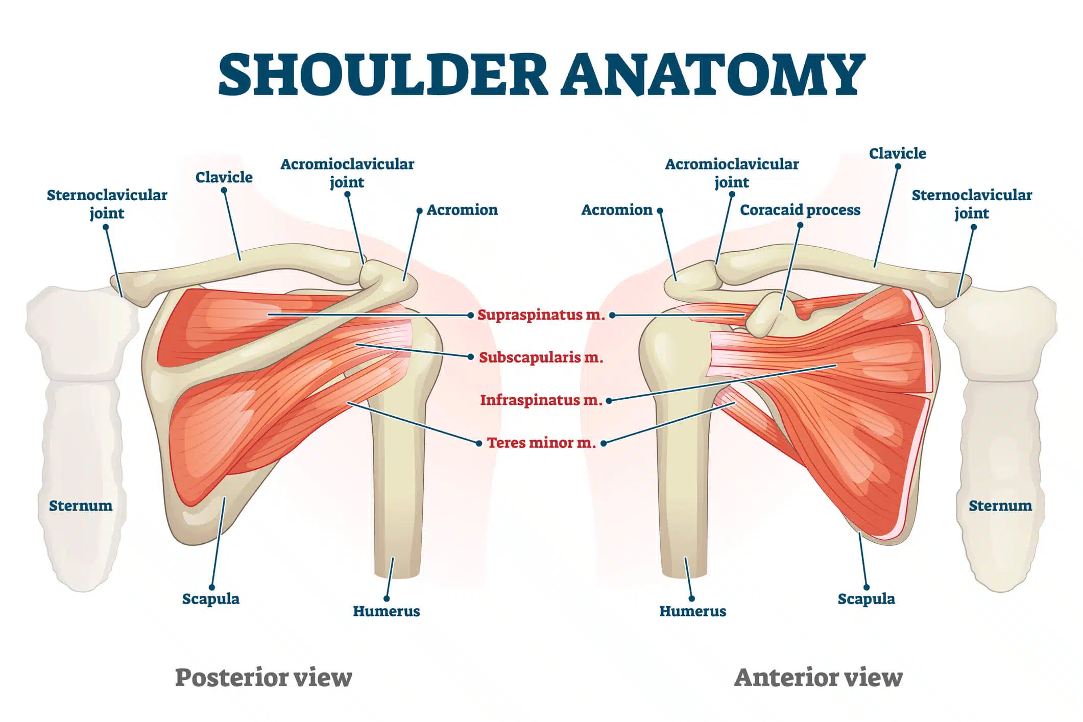 Mueller - Adjustable Arm Sling - Alleviate pain and discomfort - TRU·FIT